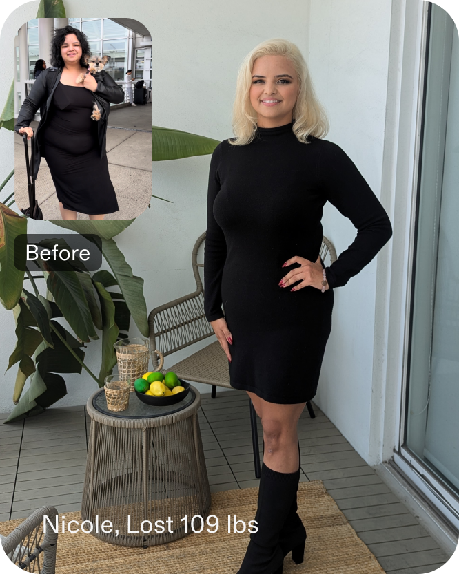 Before and after images of Nicole, a Everself ESG Stomach Tightening® patient who lose 77 pounds in 7 months