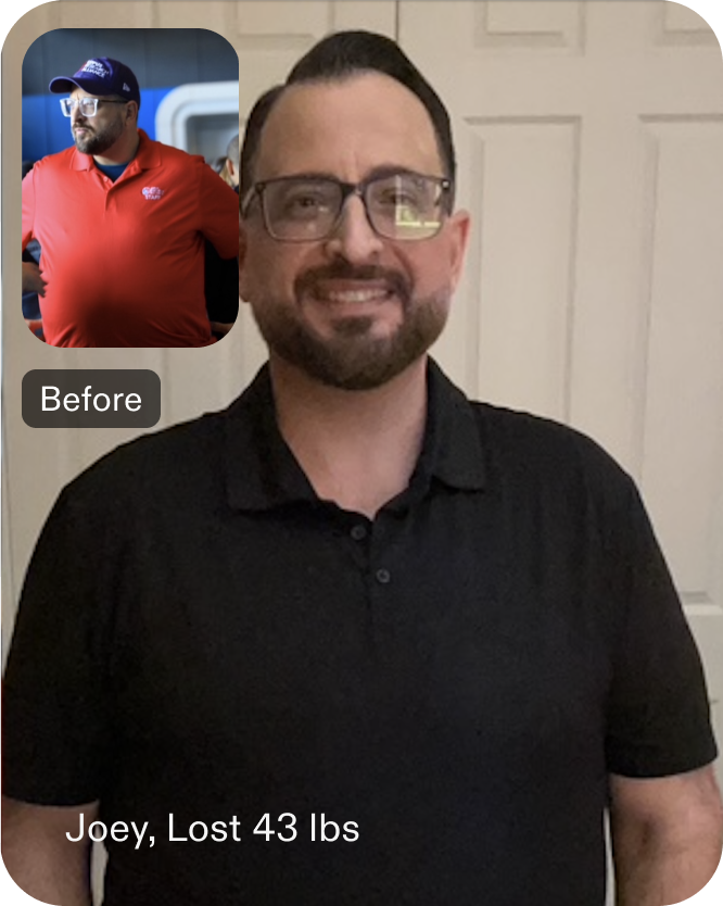 Joey lost 43 lbs with an ESG with Everself