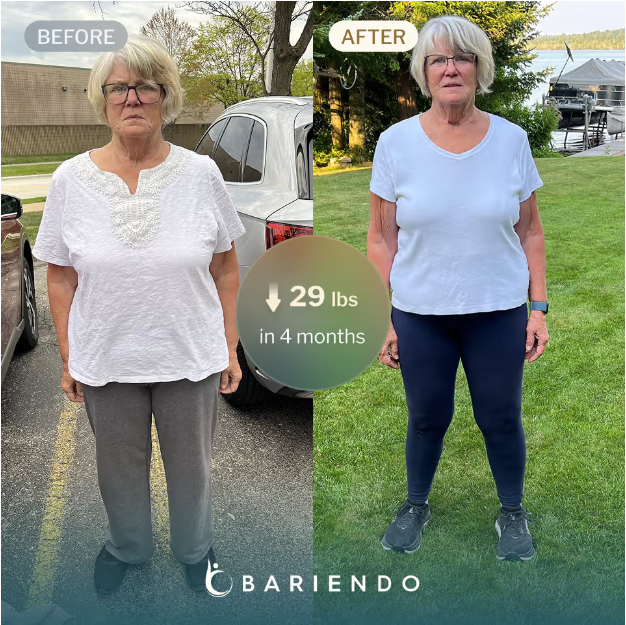 Before and after picture of an older blonde woman showing weight loss progress with ESG stomach tightening