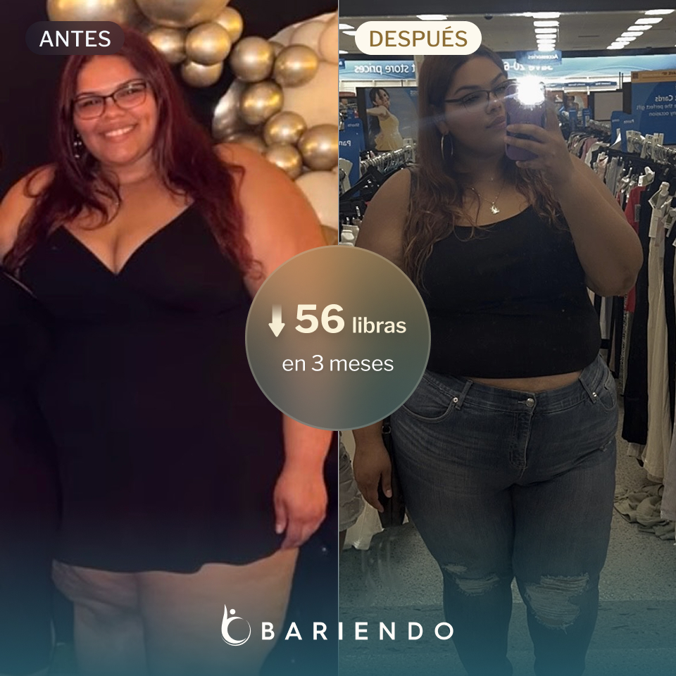 Ciaralyn lost 56 pounds with an ESG from Everself