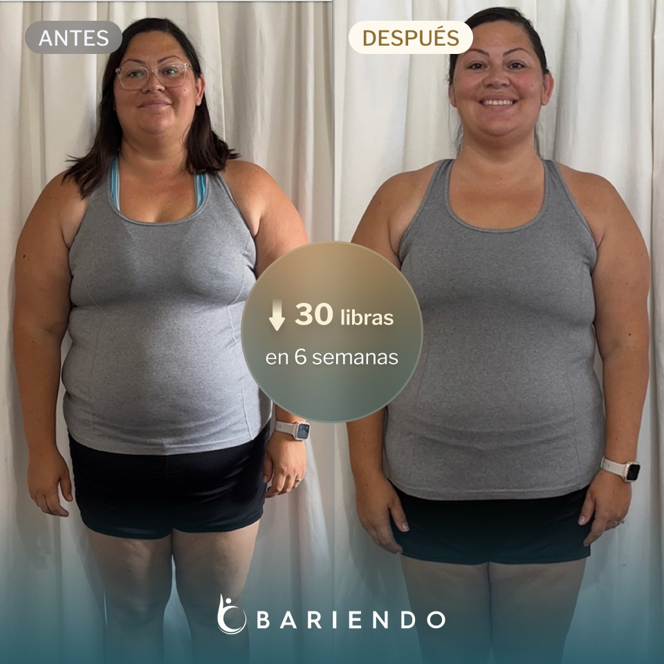 Lacy perdió 30 libras con ESG de Everself